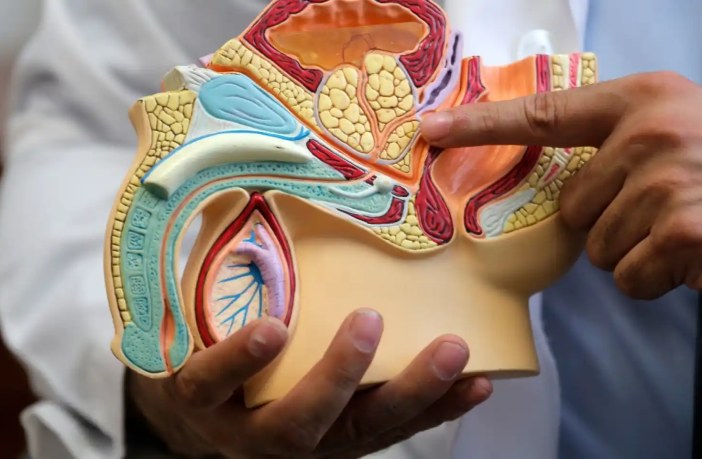 Tabúes y accesibilidad, retos en lucha contra cáncer de próstata en Hidalgo