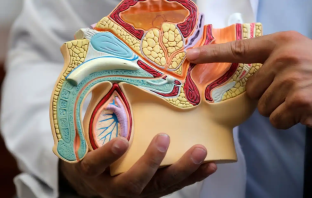 Tabúes y accesibilidad, retos en lucha contra cáncer de próstata en Hidalgo